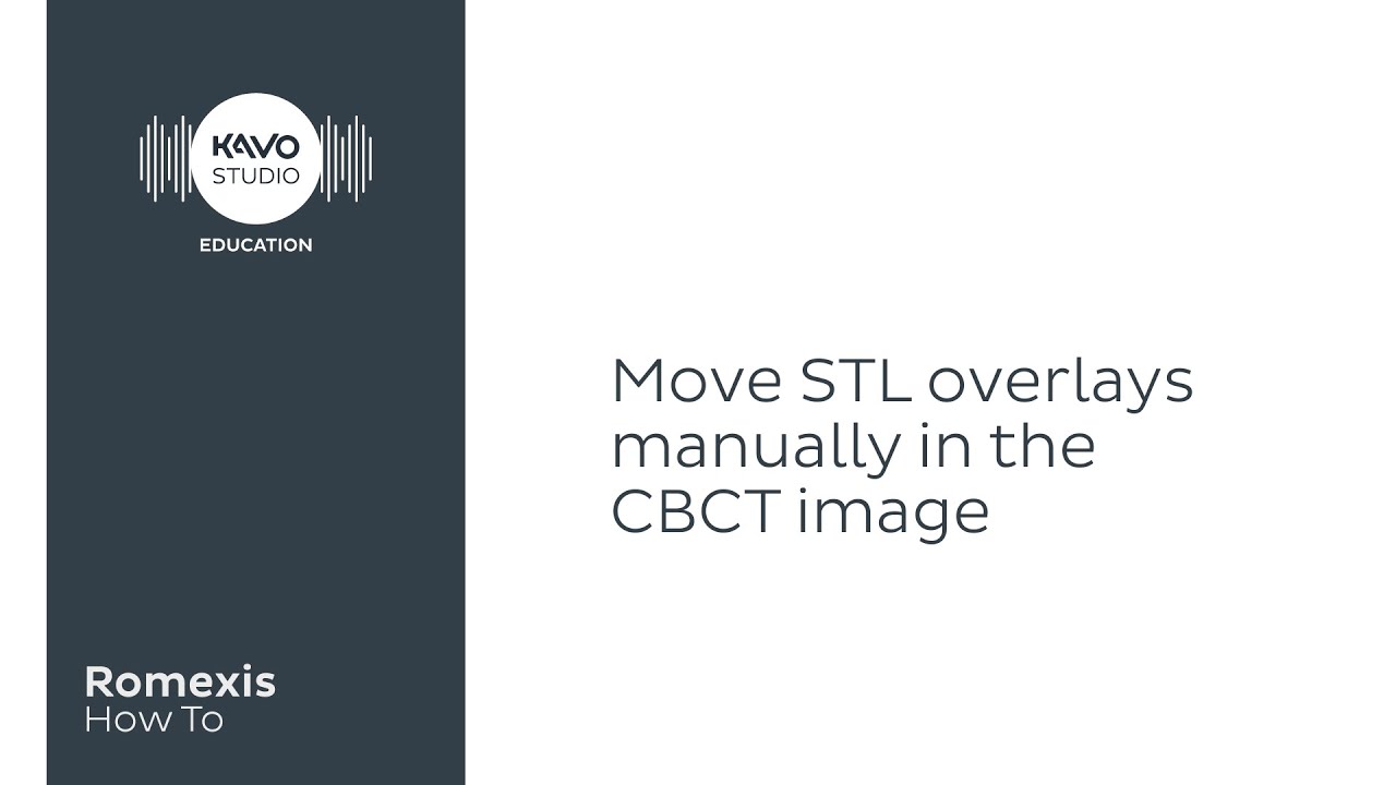 Romexis How To: Move STL scan manually in CBCT image