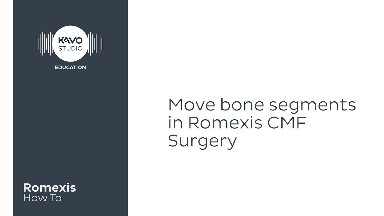 Romexis How To: Move bone segments in Romexis CMF Surgery