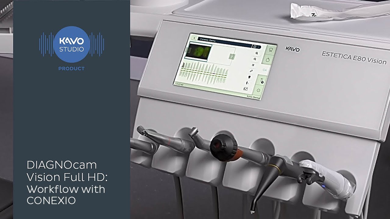 KaVo DIAGNOcam Vision Full HD: Workflow with CONEXIO on the treatment unit