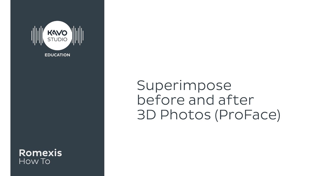 Romexis How To: Superimpose before and after 3D photos (ProFace)