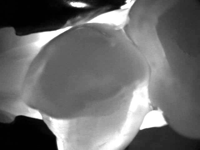 DIAGNOcam Application