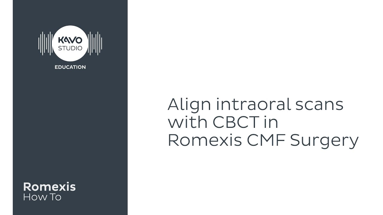 Romexis How To: Align intraoral scans with CBCT in Romexis CMF Surgery